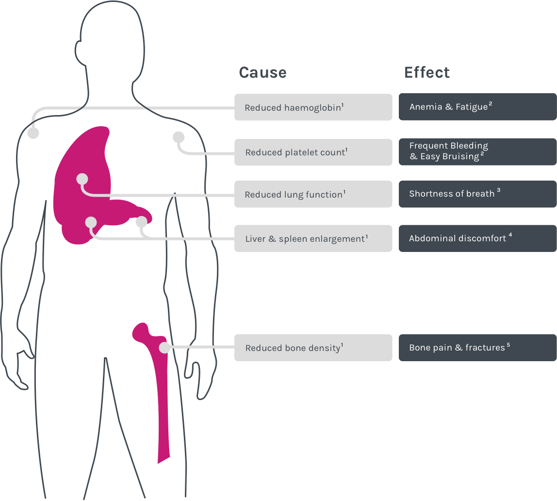 Gaucher Disease Symptoms Infographic